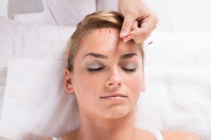 Acupuncture for Snoring